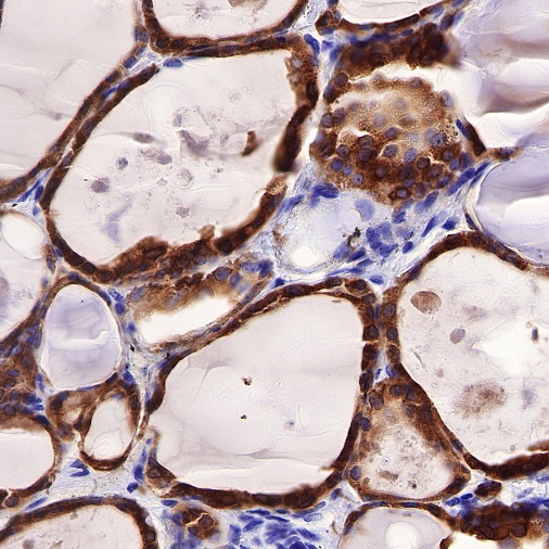 TPO Recombinant Rabbit mAb (SDT-420-57)