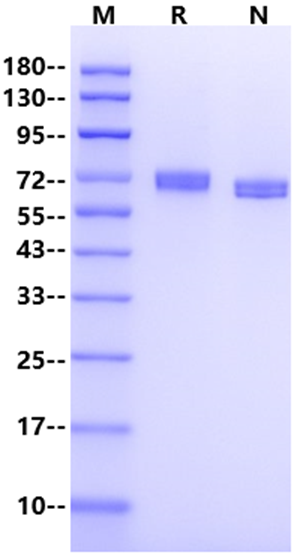 EphB1 His Tag Protein, Human