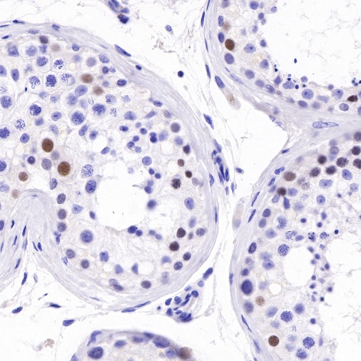 SAGE1 Recombinant Rabbit mAb (SDT-317-60)