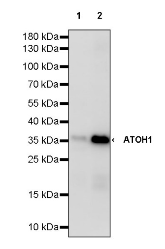 ATOH1 Recombinant Rabbit mAb (S-1301-11)