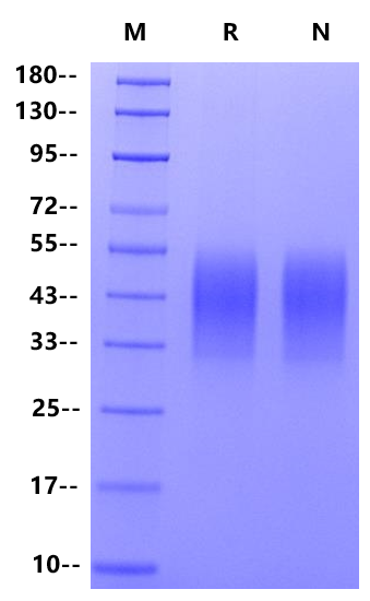 TIM-3/HAVCR2 His Tag Protein, Mouse