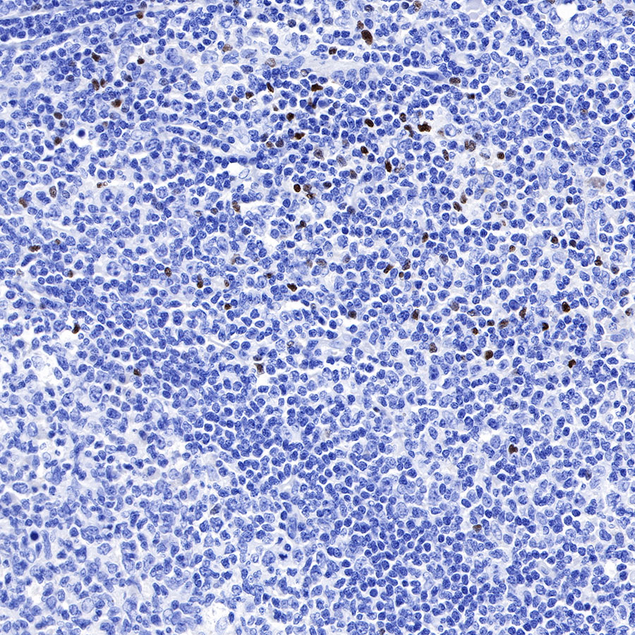 FOXP3 Recombinant Rabbit mAb (SDT-R064)