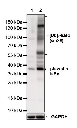 Phospho-IκBα (Ser36) Recombinant Rabbit mAb (S-R102)