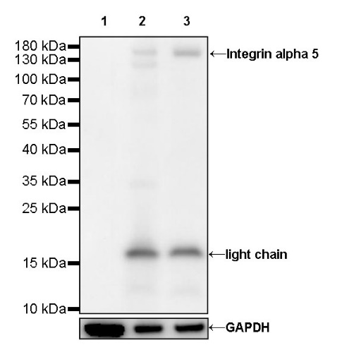 Integrin alpha 5 Recombinant Rabbit mAb (S-381-37)