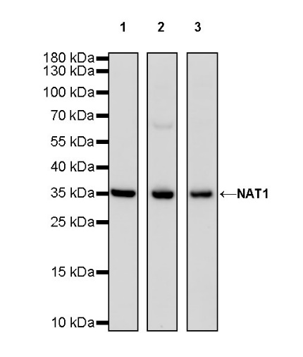 NAT1 Recombinant Rabbit mAb (S-662-109)