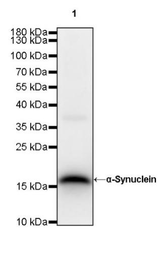 α-Synuclein Recombinant Rabbit mAb (S-441-86)