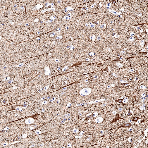 Neurofilament L Recombinant Rabbit mAb (S-635-214)