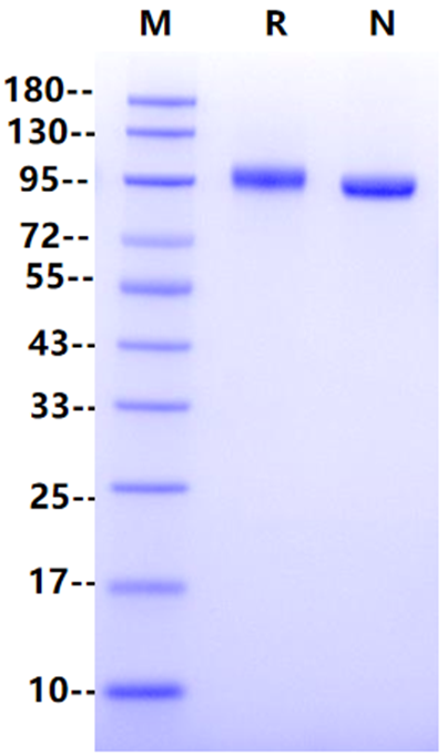PTK7/CCK4 His Tag Protein, Cynomolgus