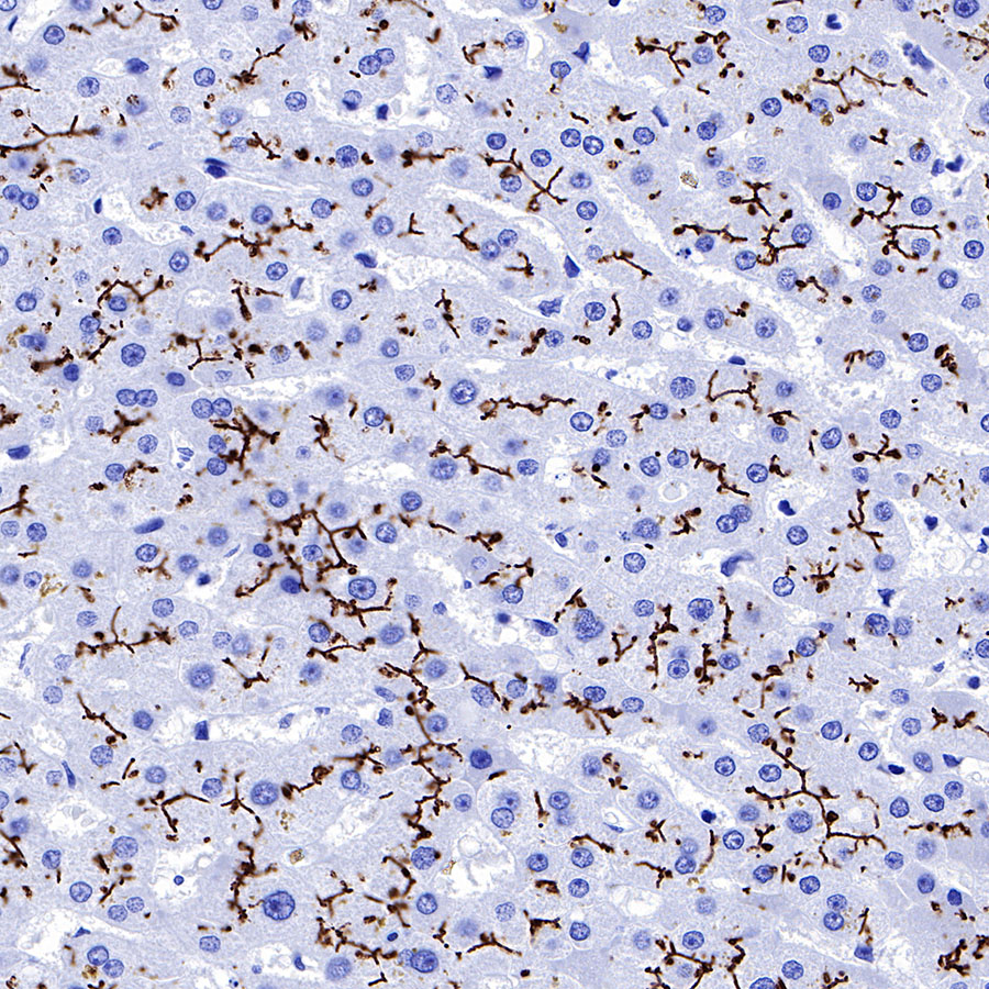 BSEP Recombinant Rabbit mAb (SDT-045-13)