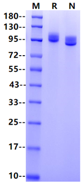 NCAM-1/CD56 His Tag Protein, Human