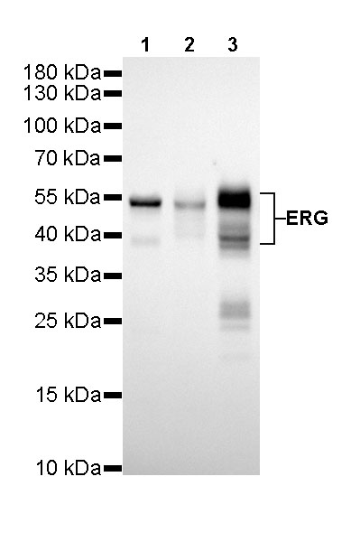 ERG Recombinant Rabbit mAb (SDT-190-65)