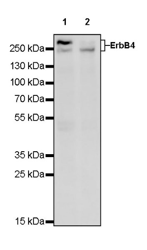 ErbB4 Recombinant Rabbit mAb (S-496-61)
