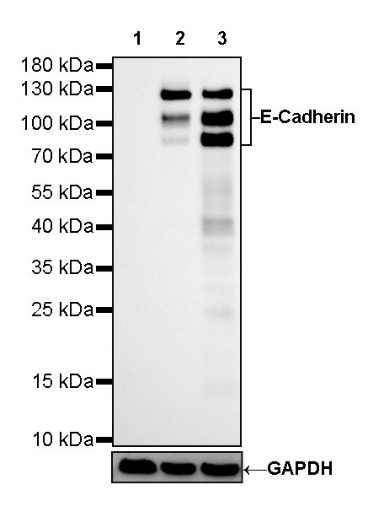S-RMab® E-Cadherin Recombinant Rabbit mAb (SDT-438-5)