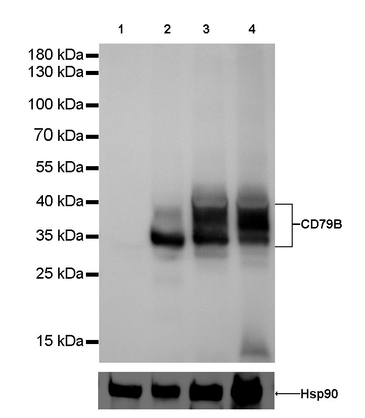CD79B Recombinant Rabbit mAb(SDT-043-9)