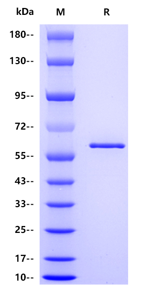 Influenza A virus NP（A/Victoria/2005/2009 H1N1）, His tag 