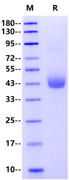 SFTPD His Tag Protein, Human