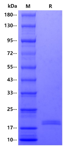 Human CD40 Ligand/TNFSF5 protein, His tag