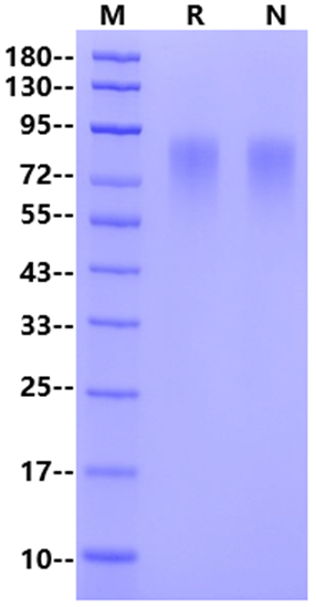 HRSVB (strain 18537) GlycoProtein G Protein, His Tag