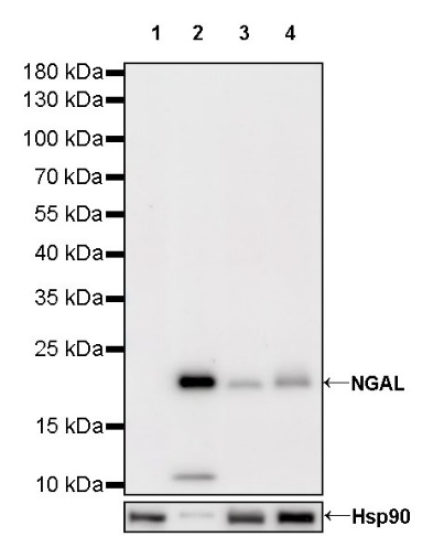 NGAL Recombinant Rabbit mAb (S-473-22)