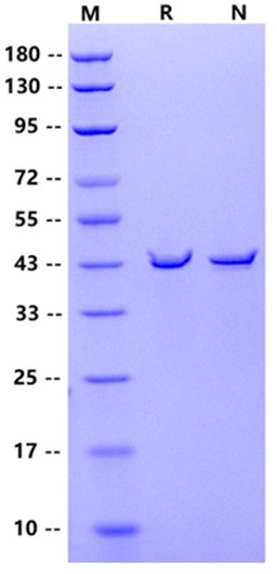 HRSV(Strain A2)Nucleoprotein,His Tag  Protein