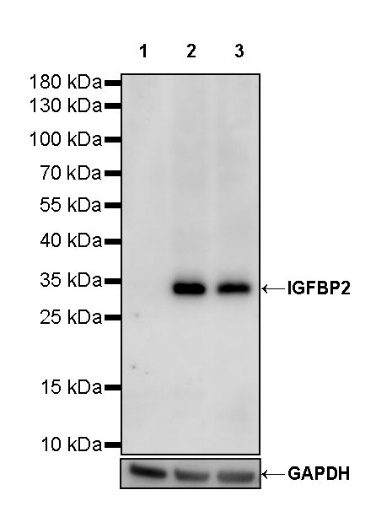 IGFBP2 Recombinant Rabbit mAb (S-808-24)