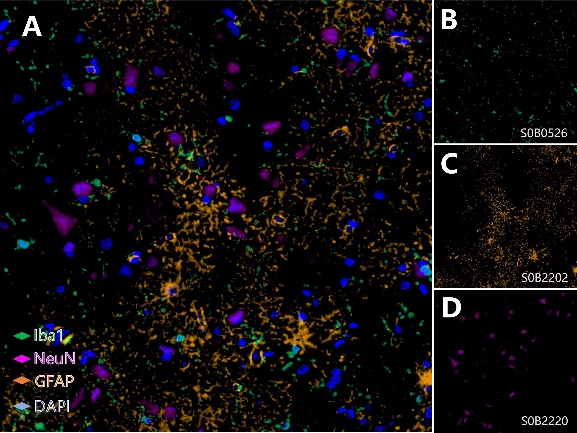 Microglia, Mature Neuron and Astrocyte Marker (Iba1, NeuN, GFAP) Antibody Panel