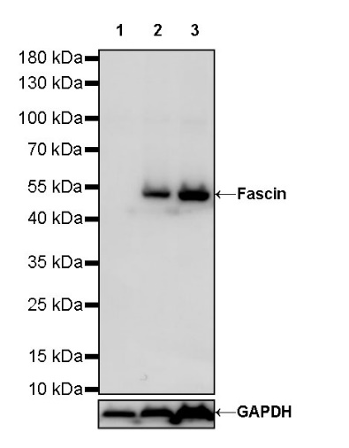 Fascin Recombinant Rabbit mAb (SDT-759-13)