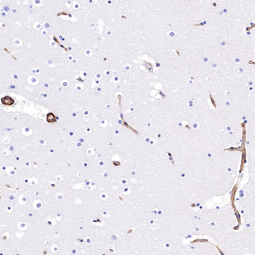 CD239 Recombinant Rabbit mAb (S-683-3)