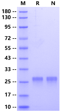 TPK1 His Tag Protein, Human