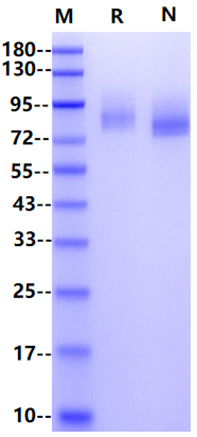 CD140b/PDGFRB His Tag Protein, Human