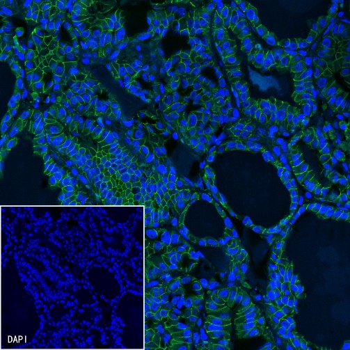 β-Catenin Recombinant Rabbit mAb (Alexa Fluor® 488 Conjugate) (S-336-23)