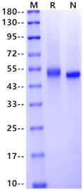 CD5 His Tag Protein, Human