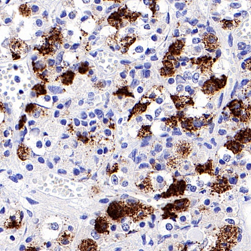 Luteinizing Hormone Beta Recombinant Rabbit mAb (SDT-545-2)
