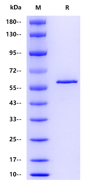 Influenza A virus NP（A/Hong Kong/1/1968 H3N2）, His tag