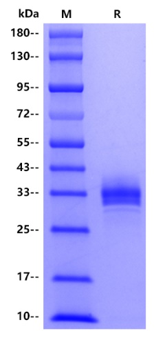 Human CD326/EPCAM, His tag