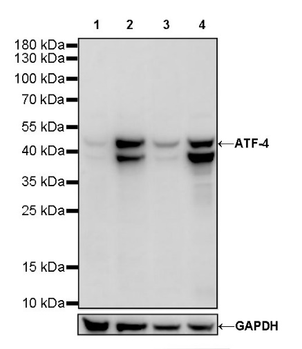 ATF-4 Recombinant Rabbit mAb (S-471-111)