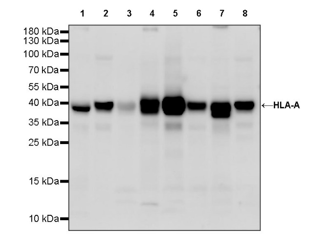 HLA-A Rabbit Polyclonal Antibody