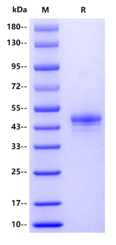 Human SHBG Protein, His tag
