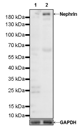 Nephrin Recombinant Rabbit mAb (S-543-63)