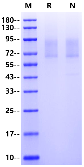PSGL-1/CD162 His Tag Protein, Human