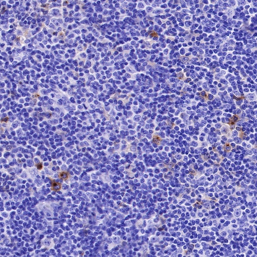 CD25/IL-2Rα Recombinant Rabbit mAb (S-R223)