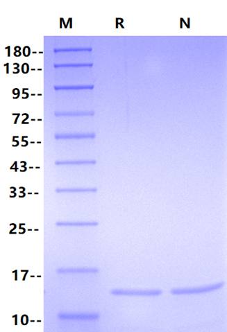HBV Surface Antigen-preS1 Protein