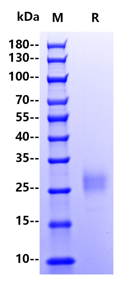 Human Collagen IV, His Tag