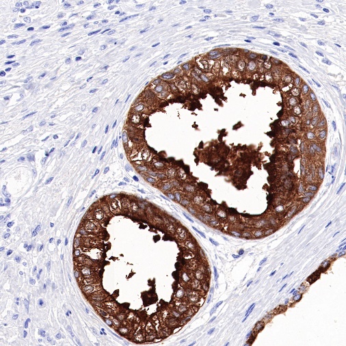 PAP Recombinant Rabbit mAb (SDT-702-140)