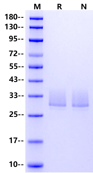ANGPTL3(17-220) His Tag Protein, Human