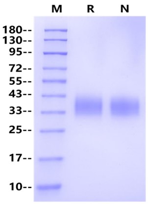 B7-H5/VISTA His Tag Protein, Mouse