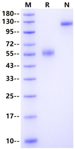 TREM2 Fc Chimera Protein, Human
