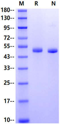RENIN (R66K) His Tag Protein, Human