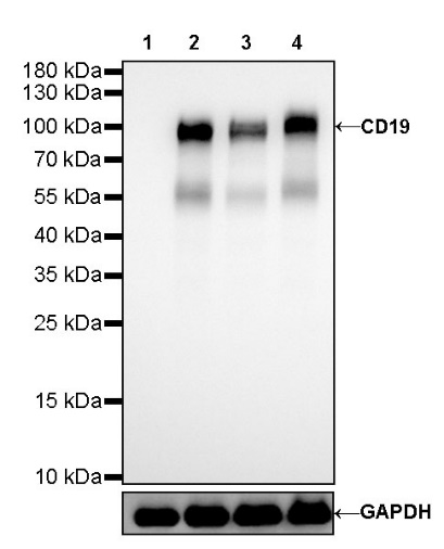 CD19 Recombinant Rabbit mAb (SDT-164-41)