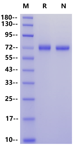 H1N1 HA (A/WSN/1933) His Tag